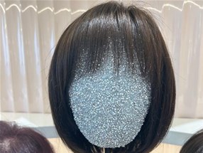 防止脱发从生活小事做起