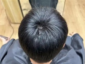 为何我们不推荐你用自己头发制作假发？
